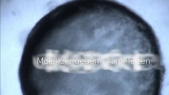 thumbnail of medium Moleküle gegen Krankheiten (Quelle: DFG)